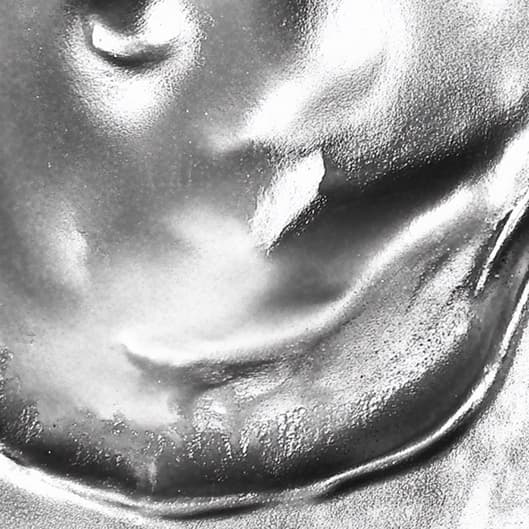 Damaged Nails/Nail Fungus Treatment at Nail Haven Co in San Diego, CA